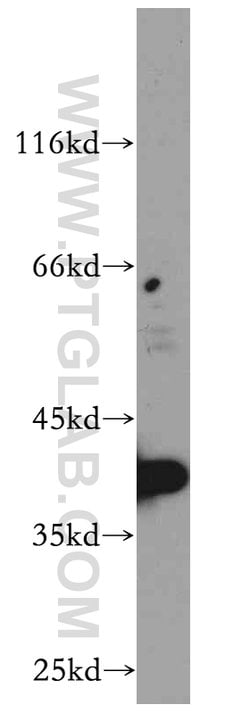 RP2 Rabbit anti-Human, Mouse, Rat, Polyclonal, Proteintech 150 &mu;L; Unconjugated:Antibodies,