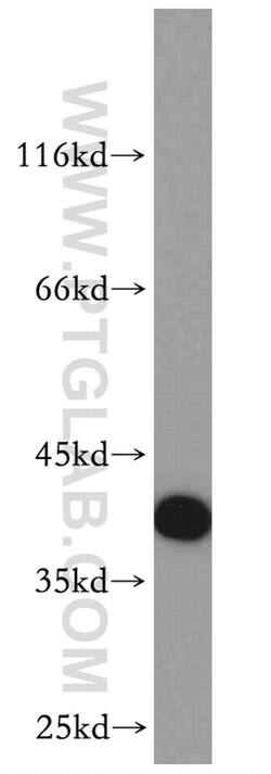 RP2 Rabbit anti-Human, Mouse, Rat, Polyclonal, Proteintech 150 &mu;L; Unconjugated:Antibodies,