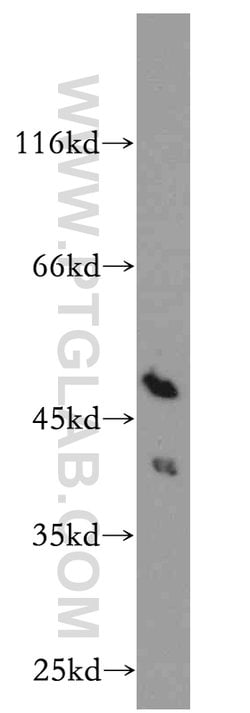 RP2 Rabbit anti-Human, Mouse, Rat, Polyclonal, Proteintech 150 &mu;L; Unconjugated:Antibodies,