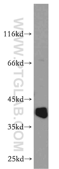 RP2 Rabbit anti-Human, Mouse, Rat, Polyclonal, Proteintech 150 &mu;L; Unconjugated:Antibodies,