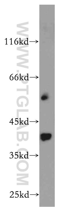 RP2 Rabbit anti-Human, Mouse, Rat, Polyclonal, Proteintech 150 &mu;L; Unconjugated:Antibodies,