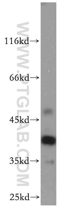 RP2 Rabbit anti-Human, Mouse, Rat, Polyclonal, Proteintech 150 &mu;L; Unconjugated:Antibodies,