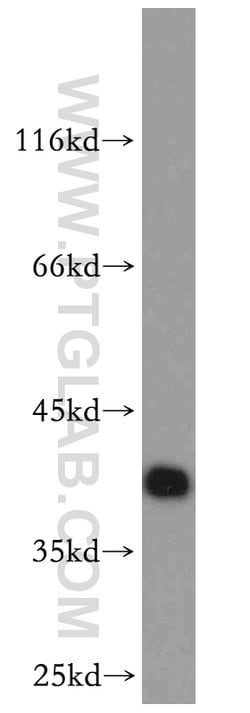RP2 Rabbit anti-Human, Mouse, Rat, Polyclonal, Proteintech 150 &mu;L; Unconjugated:Antibodies,