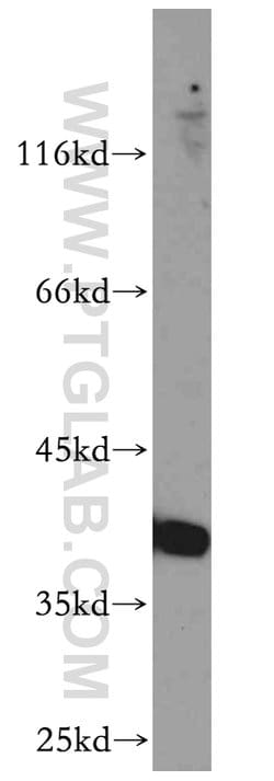 RP2 Rabbit anti-Human, Mouse, Rat, Polyclonal, Proteintech 150 &mu;L; Unconjugated:Antibodies,