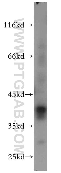 RP2 Rabbit anti-Human, Mouse, Rat, Polyclonal, Proteintech 150 &mu;L; Unconjugated:Antibodies,