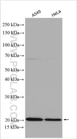 IL-18BP Rabbit anti-Human, Mouse, Rat, Polyclonal, ProteinTech 150 &mu;L;
