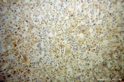 MIPOL1 Rabbit anti-Human, Polyclonal, Proteintech 150 μL; Unconjugated:Antibodies,