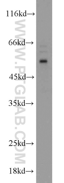 MIPOL1 Rabbit anti-Human, Polyclonal, Proteintech 150 μL; Unconjugated:Antibodies,