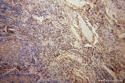 BET1L Rabbit anti-Human, Mouse, Rat, Polyclonal, Proteintech:Antibodies:Primary