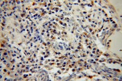 BET1L Rabbit anti-Human, Mouse, Rat, Polyclonal, Proteintech:Antibodies:Primary