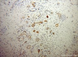 PTH2R Rabbit anti-Human, Mouse, Rat, Polyclonal, Proteintech 150 &mu;L;