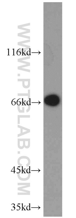 PTH2R Rabbit anti-Human, Mouse, Rat, Polyclonal, Proteintech 150 &mu;L;