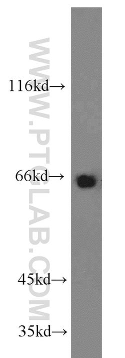 PTH2R Rabbit anti-Human, Mouse, Rat, Polyclonal, Proteintech 150 &mu;L;
