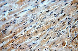 B3GALT2 Rabbit anti-Human, Mouse, Rat, Polyclonal, Proteintech 20 &mu;L;