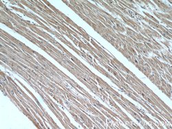 B3GALT2 Rabbit anti-Human, Mouse, Rat, Polyclonal, Proteintech 20 &mu;L;