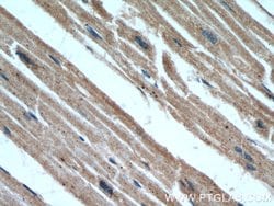 B3GALT2 Rabbit anti-Human, Mouse, Rat, Polyclonal, Proteintech 20 &mu;L;