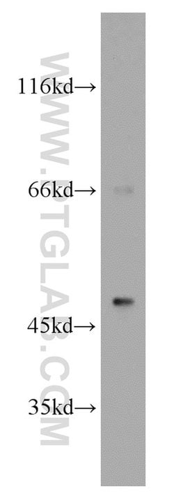 B3GALT2 Rabbit anti-Human, Mouse, Rat, Polyclonal, Proteintech 20 &mu;L;