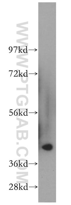HSD11B2 Rabbit anti-Human, Mouse, Rat, Polyclonal, Proteintech 20 &mu;L;