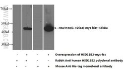 HSD11B2 Rabbit anti-Human, Mouse, Rat, Polyclonal, Proteintech 20 &mu;L;