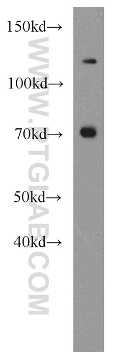 CAT-1 Rabbit anti-Human, Mouse, Rat, Polyclonal, Proteintech 150 &mu;L;