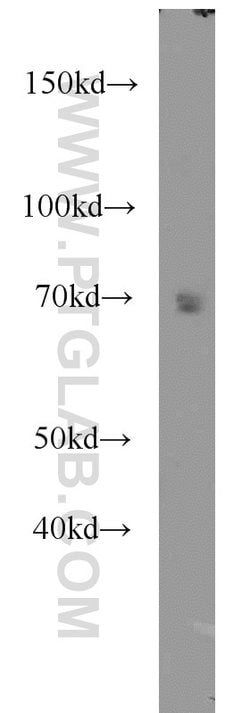 CAT-1 Rabbit anti-Human, Mouse, Rat, Polyclonal, Proteintech 150 &mu;L;