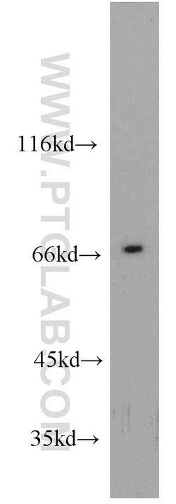 CAT-1 Rabbit anti-Human, Mouse, Rat, Polyclonal, Proteintech 150 &mu;L;