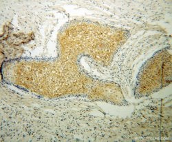 CAT-1 Rabbit anti-Human, Mouse, Rat, Polyclonal, Proteintech 150 &mu;L;