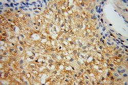 CAT-1 Rabbit anti-Human, Mouse, Rat, Polyclonal, Proteintech 150 &mu;L;