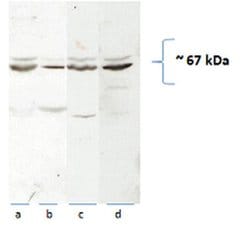 CAT-1 Rabbit anti-Human, Mouse, Rat, Polyclonal, Proteintech 150 &mu;L;