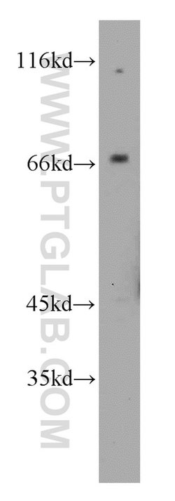 CAT-1 Rabbit anti-Human, Mouse, Rat, Polyclonal, Proteintech 150 &mu;L;