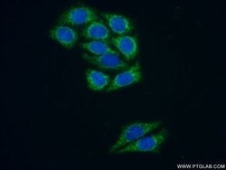TNK1 Rabbit anti-Human, Mouse, Rat, Polyclonal, Proteintech:Antibodies:Primary