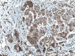 TNK1 Rabbit anti-Human, Mouse, Rat, Polyclonal, Proteintech:Antibodies:Primary