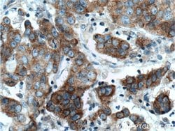 TNK1 Rabbit anti-Human, Mouse, Rat, Polyclonal, Proteintech:Antibodies:Primary
