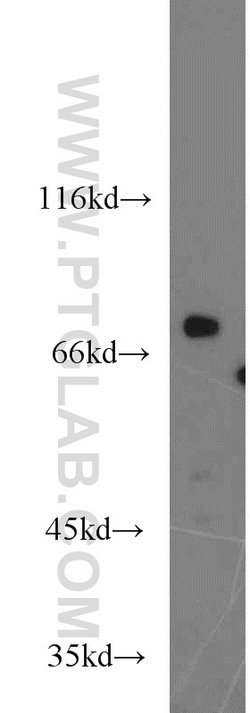 TNK1 Rabbit anti-Human, Mouse, Rat, Polyclonal, Proteintech:Antibodies:Primary