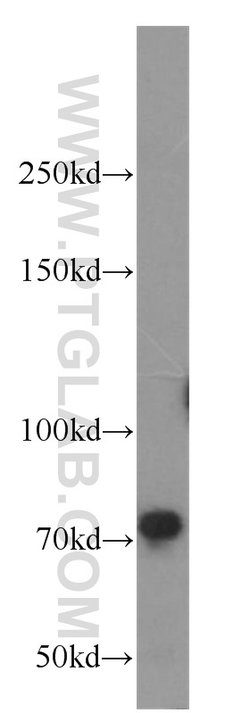 TNK1 Rabbit anti-Human, Mouse, Rat, Polyclonal, Proteintech:Antibodies:Primary
