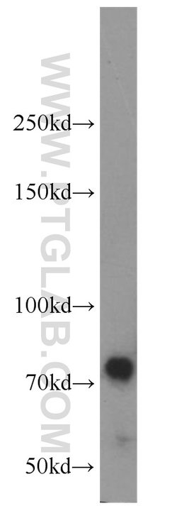 TNK1 Rabbit anti-Human, Mouse, Rat, Polyclonal, Proteintech:Antibodies:Primary