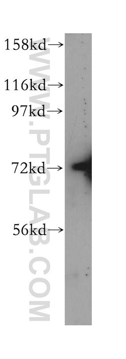 TNK1 Rabbit anti-Human, Mouse, Rat, Polyclonal, Proteintech:Antibodies:Primary