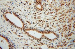CSTF2T Rabbit anti-Human, Mouse, Rat, Polyclonal, Proteintech:Antibodies:Primary
