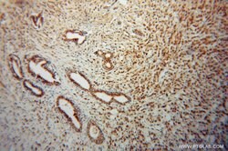 CSTF2T Rabbit anti-Human, Mouse, Rat, Polyclonal, Proteintech:Antibodies:Primary