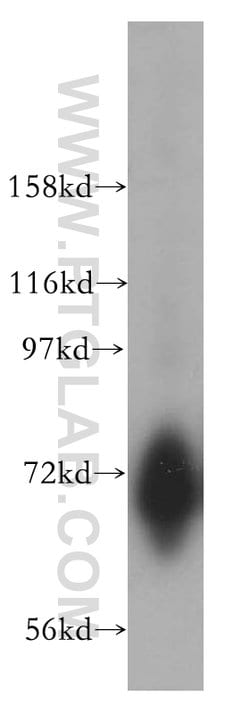 CSTF2T Rabbit anti-Human, Mouse, Rat, Polyclonal, Proteintech:Antibodies:Primary