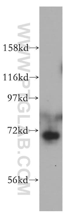 CSTF2T Rabbit anti-Human, Mouse, Rat, Polyclonal, Proteintech:Antibodies:Primary