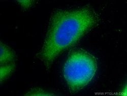 CD39/ENTPD1 Rabbit anti-Human, Mouse, Rat, Polyclonal, Proteintech 150