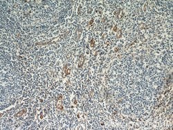 CD39/ENTPD1 Rabbit anti-Human, Mouse, Rat, Polyclonal, Proteintech 150