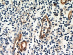 CD39/ENTPD1 Rabbit anti-Human, Mouse, Rat, Polyclonal, Proteintech 150