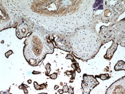 CD39/ENTPD1 Rabbit anti-Human, Mouse, Rat, Polyclonal, Proteintech 150
