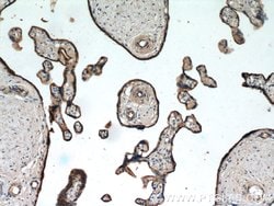 CD39/ENTPD1 Rabbit anti-Human, Mouse, Rat, Polyclonal, Proteintech 150