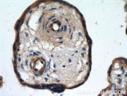 CD39/ENTPD1 Rabbit anti-Human, Mouse, Rat, Polyclonal, Proteintech 150
