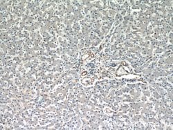CD39/ENTPD1 Rabbit anti-Human, Mouse, Rat, Polyclonal, Proteintech 150