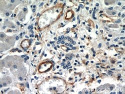 CD39/ENTPD1 Rabbit anti-Human, Mouse, Rat, Polyclonal, Proteintech 150