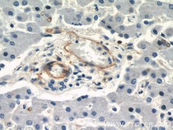 CD39/ENTPD1 Rabbit anti-Human, Mouse, Rat, Polyclonal, Proteintech 150